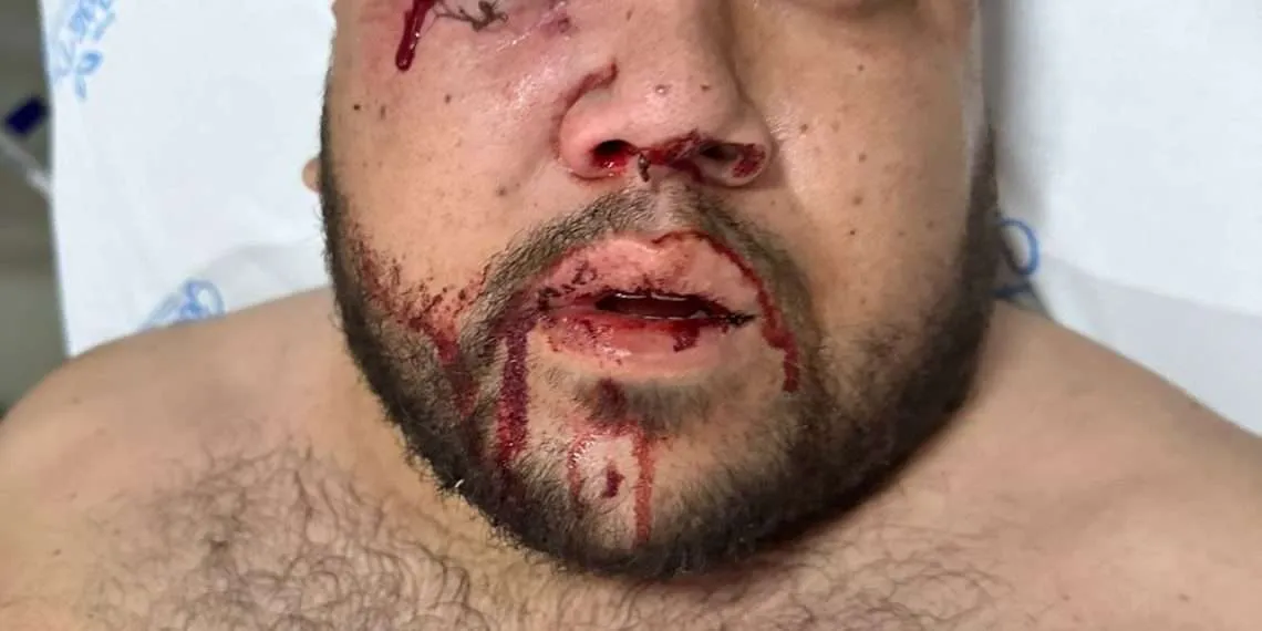 Tensão se eleva e risco de morte entre indígenas e produtores em Terra Roxa e Guaíra é grande